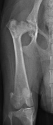 無菌性大腿骨頭壊死症